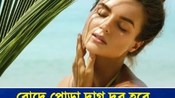 রোদে পোড়া দাগ দূর হবে বেসনের এই বিশেষ প্যাকেই