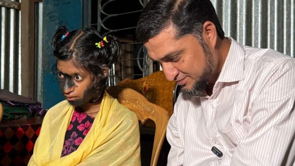 জুলেখার মুখে অচেনা দাগ, নিতে হবে বিদেশে