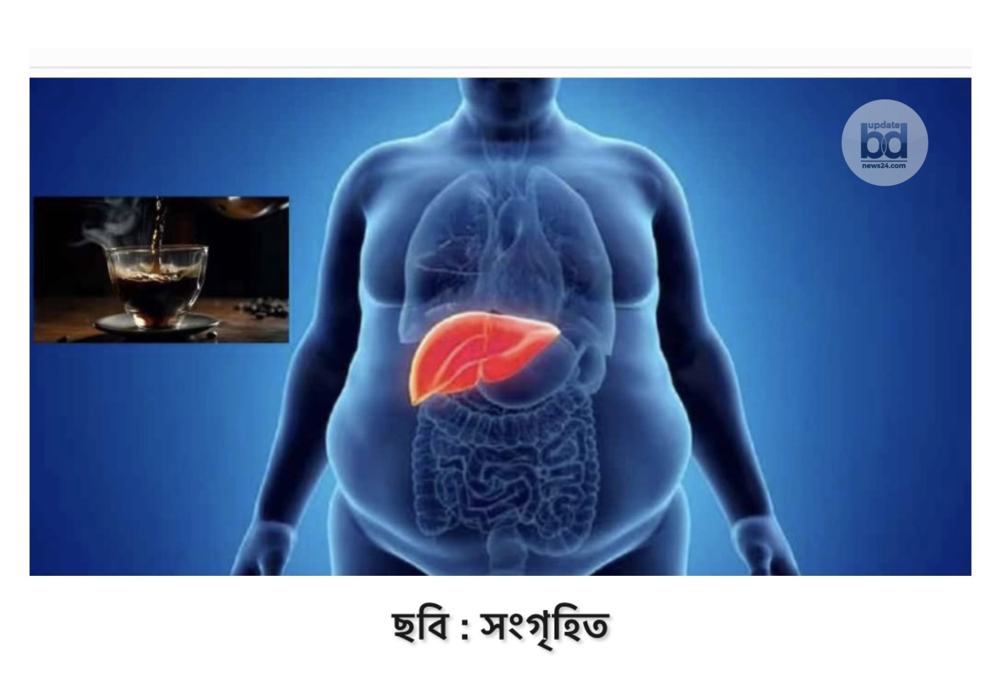 এক পানীয়তে কমবে ফ্যাটি লিভারের সমস্যা